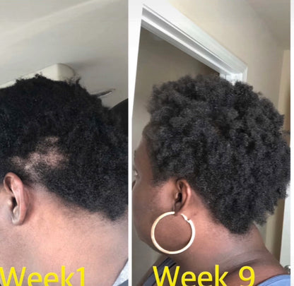 Ruthi Hair Growth Complete Set . Ruthi Hair Growth Complete Set | Rosemary & Mint Shampoo, Conditioner, Hair Mask, Hair Serum, Growth Oil & Pomade