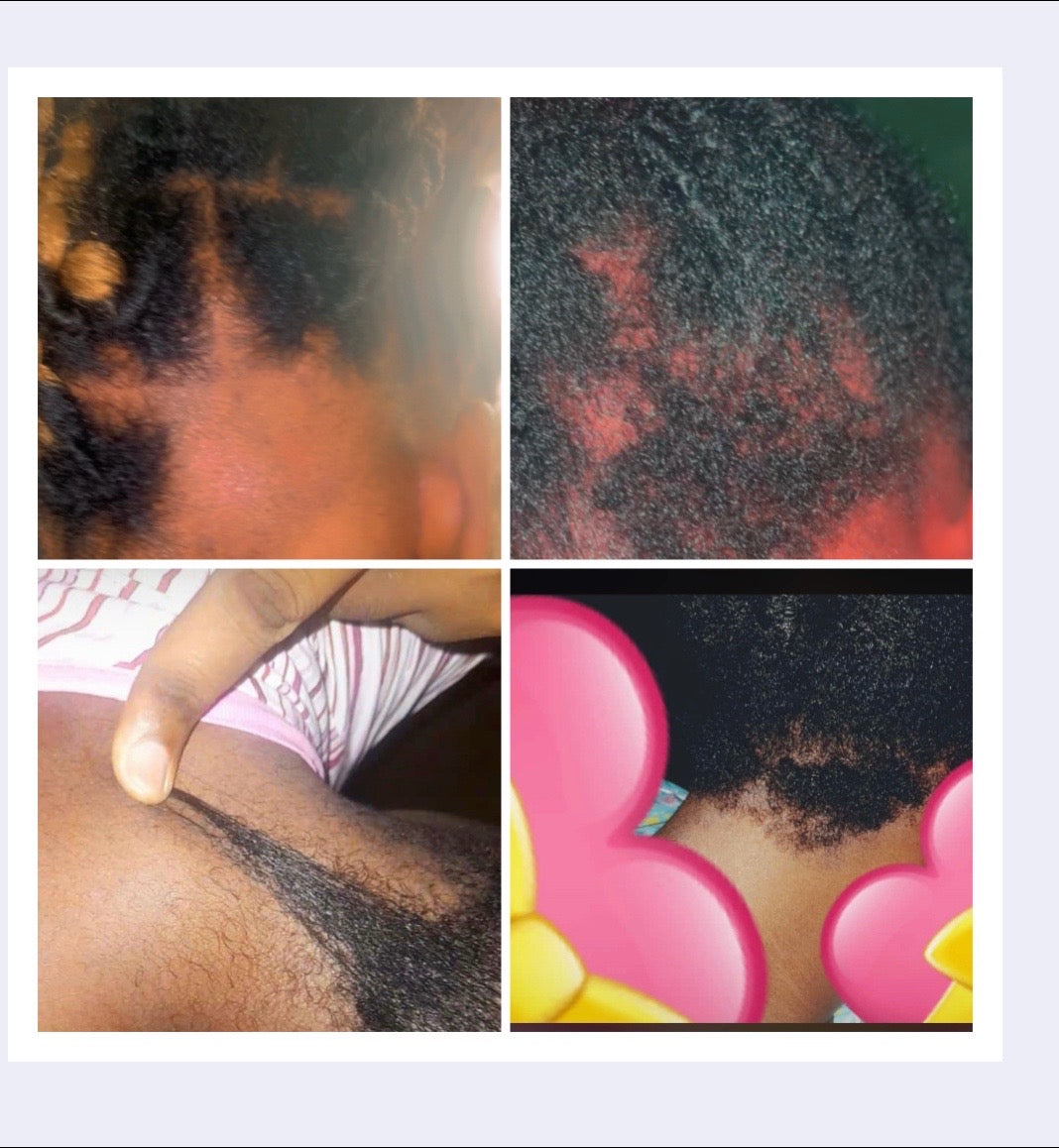 Ruthi Hair Growth Complete Set . Ruthi Hair Growth Complete Set | Rosemary & Mint Shampoo, Conditioner, Hair Mask, Hair Serum, Growth Oil & Pomade